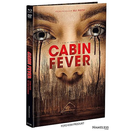 Klicke auf die Grafik für eine vergrößerte Ansicht

Name: cabin-fever-4-original.jpg
Ansichten: 75
Größe: 652,0 KB
ID: 286352